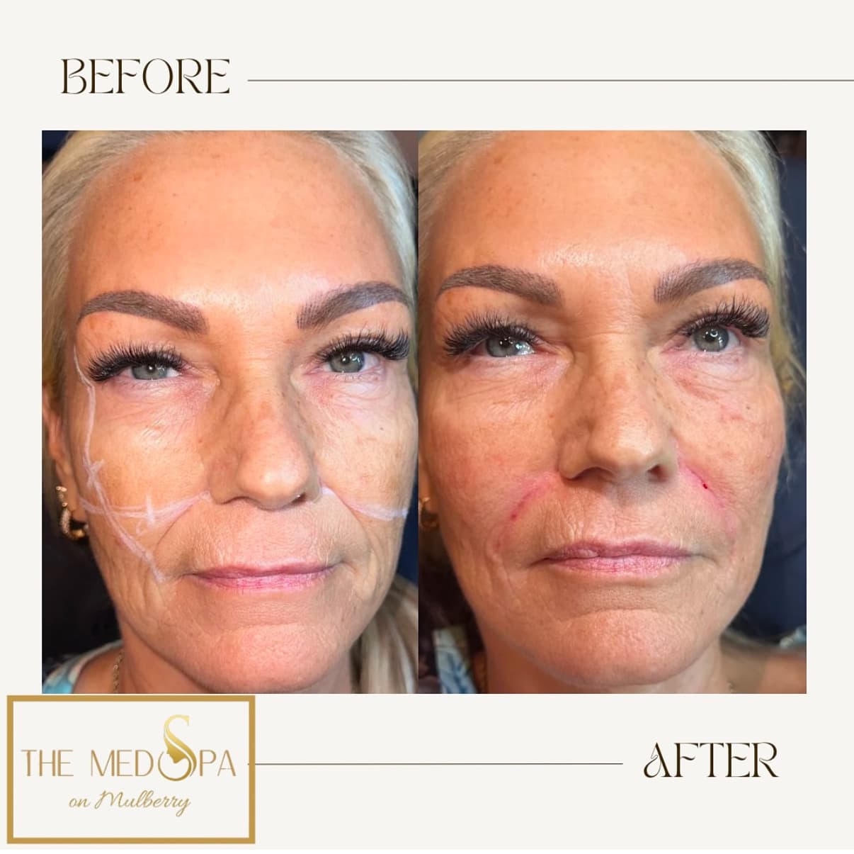 The MedSpa at Galleria