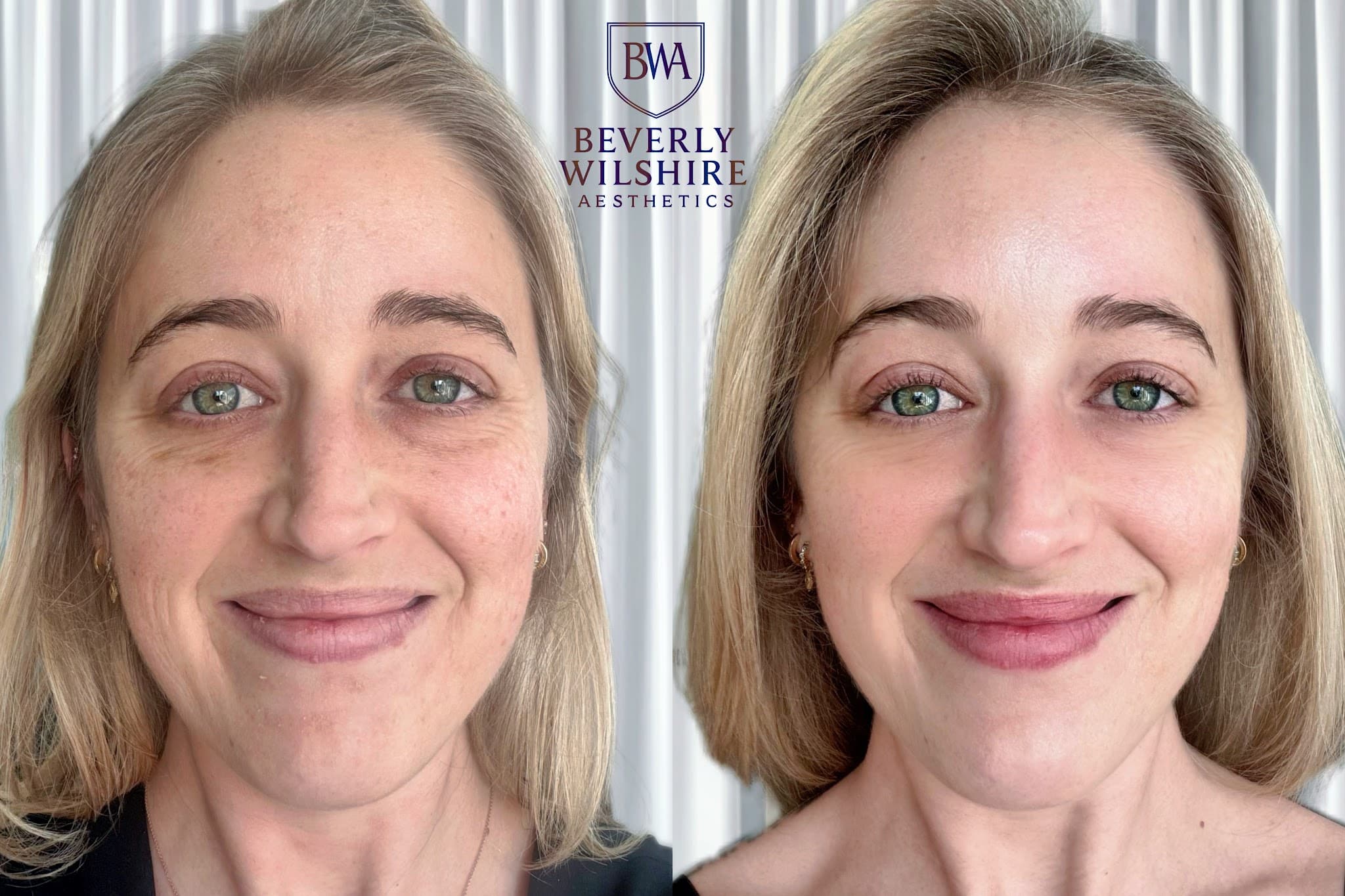 Beverly Wilshire Aesthetics Beverly Hills Medical Spa