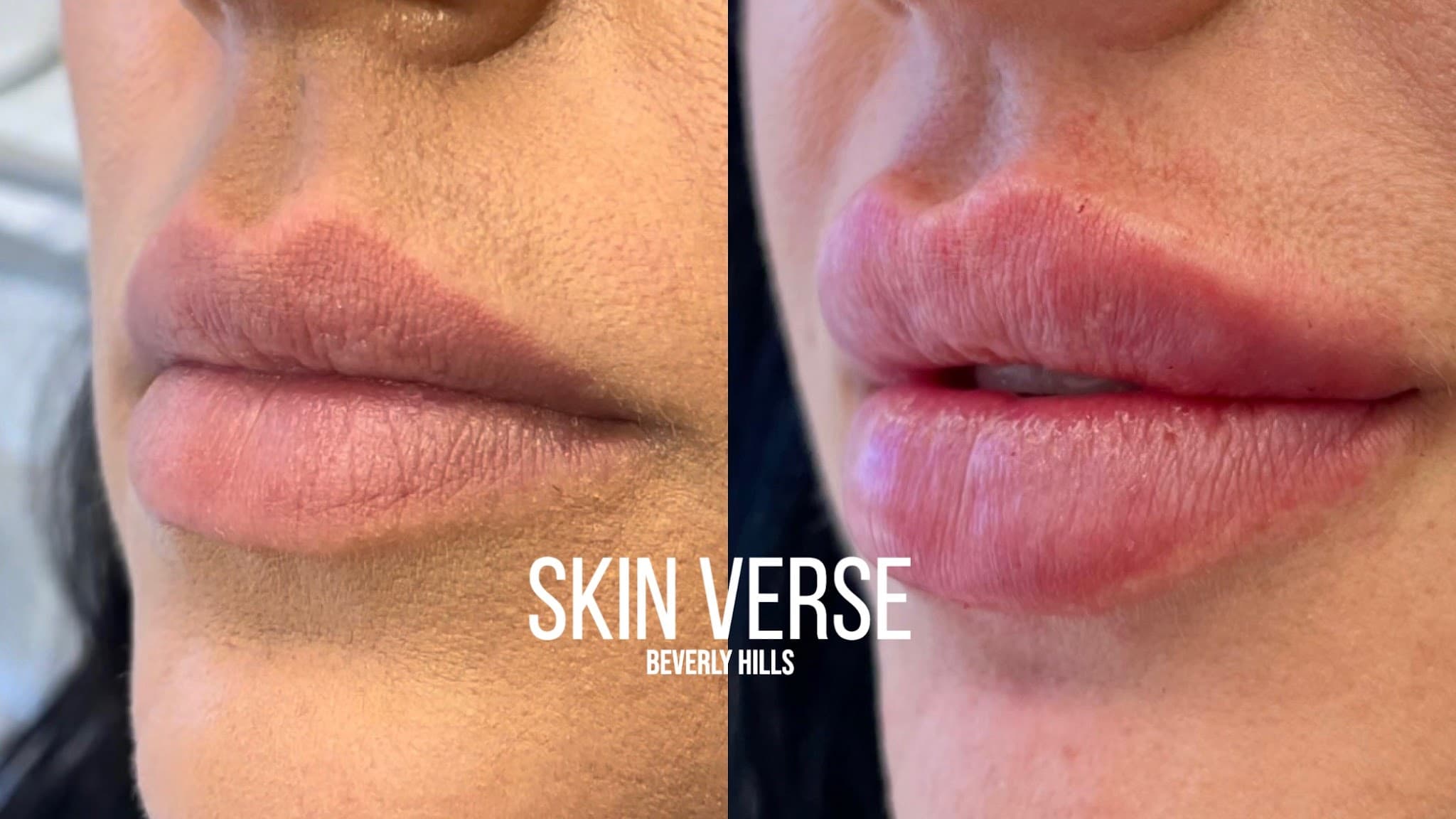 Skin Verse Medical Spa
